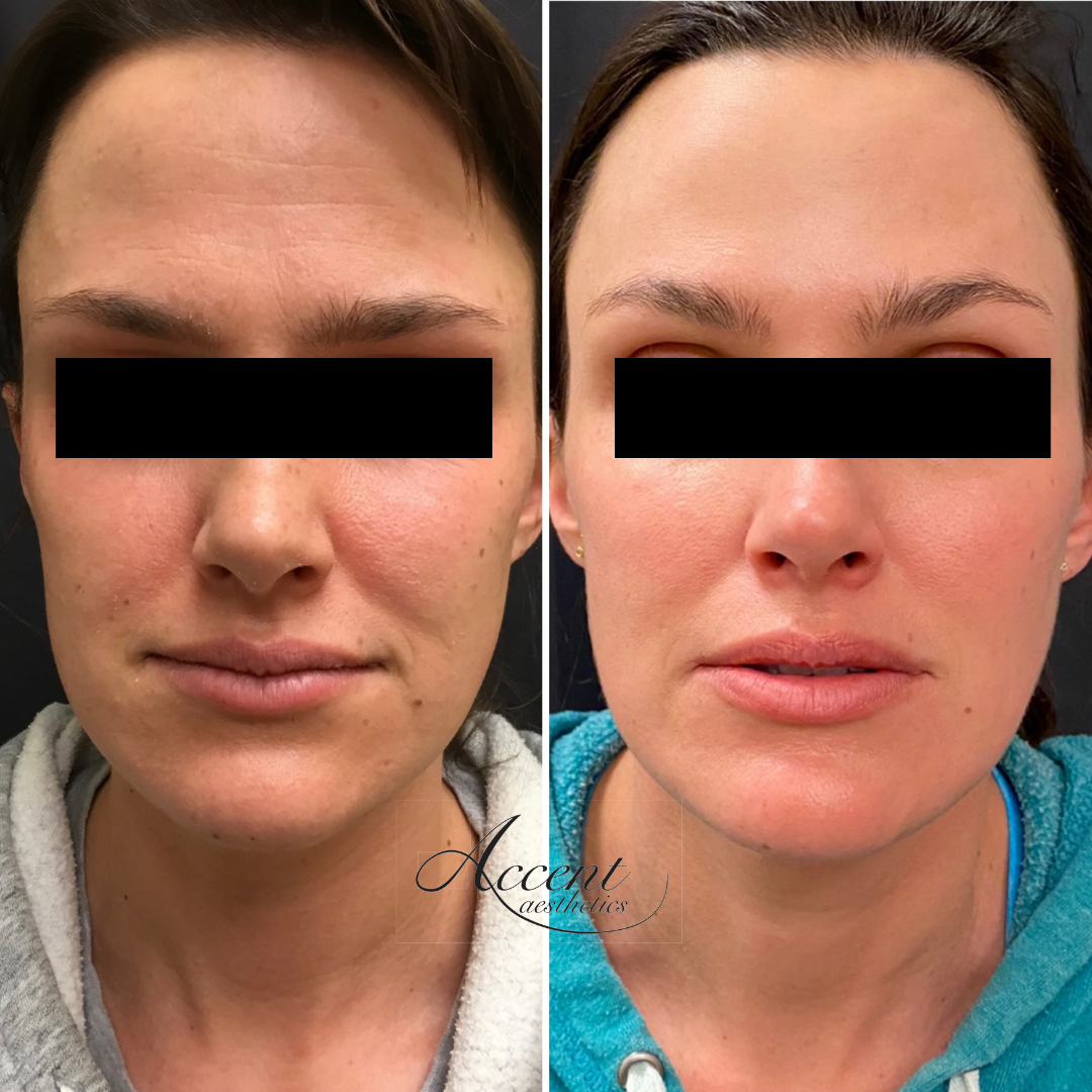 EP-Rejuvenation (1)