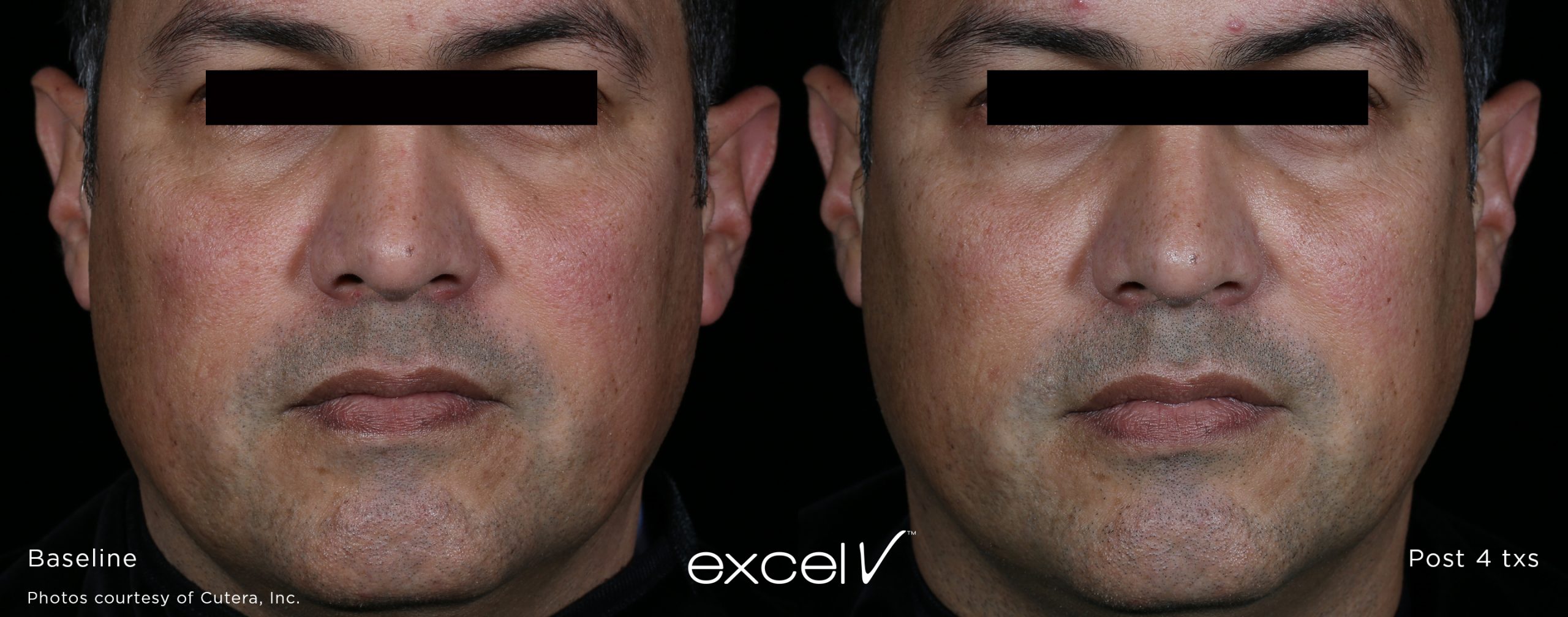 genesis-before-and-after-scaled