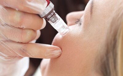 Read more about the article Discover the Best Skincare Treatments at Accent Aesthetics